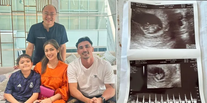 Bukan Karena Kesulitan Hamil Atau Tak Subur, 8 Potret Dokter Ungkap Alasan Spesifik Jessica Iskandar dan Vincent Verhaag Jalani Program Bayi Tabung