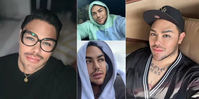 Deretan Foto Selfie Terbaru Ivan Gunawan Usai Oplas Hidung di Turki, Bibir Tebalnya Bikin Netizen Salfok