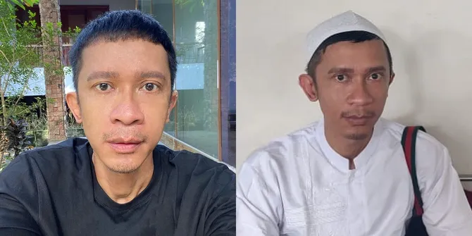 Dulu Dandan Ala Wanita Pakai Payudara Palsu, Potret Terbaru Aming Kenakan Baju Koko dan Peci - Netizen: Sudah Tobat?