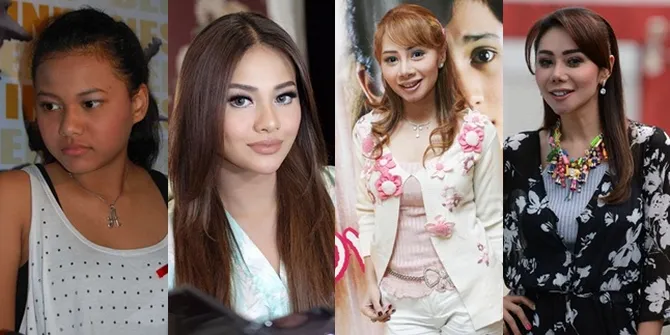FOTO: Berubah Drastis-Makin Cantik, 12 Seleb Ini Operasi Plastik?