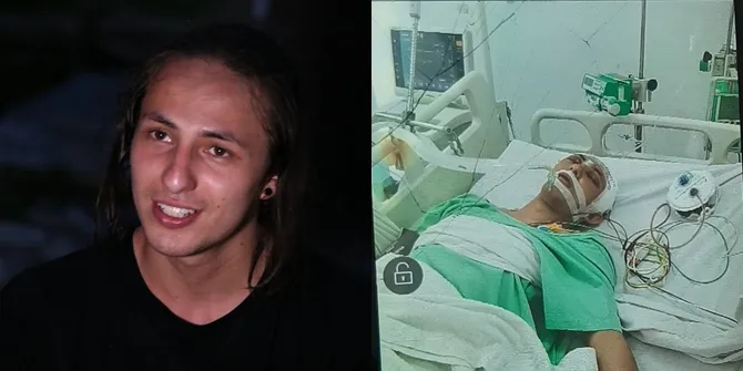 Foto Dylan Carr Dirawat Intensif, Banyak Selang dan Ditemani Boneka