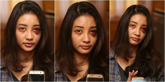 FOTO: Kronologi Pemukulan Saori Ishii, Mantan Model Asal Jepang
