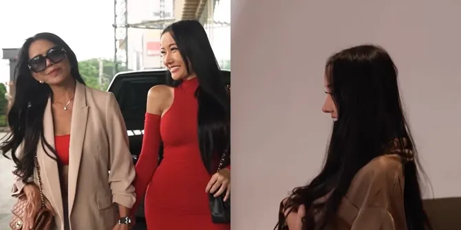 Foto Lucinta Luna Tunjukkan Hasil Operasi Kelamin Kepada Ibu Boy William, Dibilang Bagus dan Sama