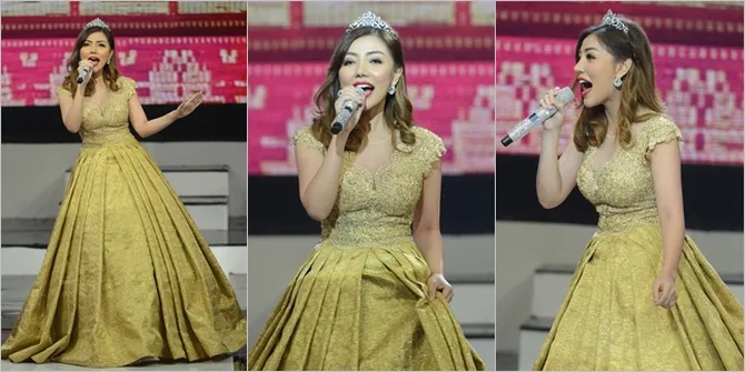 FOTO: Menahan Luka, Bella Shofie Tetap Tampil Secantik Princess!
