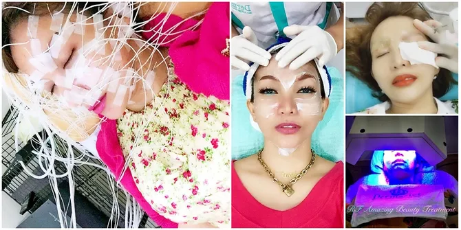 FOTO: Perawatan Kecantikan Roro Fitria, Sulam Bibir-Serum Diamond