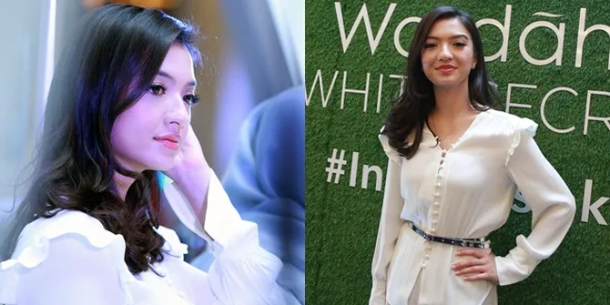 FOTO: Pernah Berjerawat, Begini Tips Kecantikan Dari Raline Shah