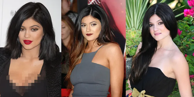 FOTO: Transformasi Kylie Jenner Sebelum & Sesudah Operasi Plastik