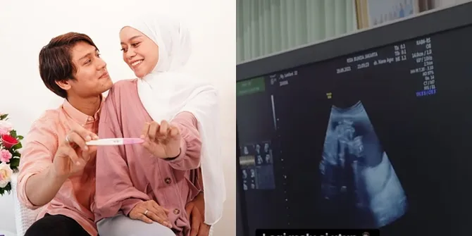 Hasil USG Tuai Perdebatan, 7 Kronologi Usia Kandungan Lesti Mulai Terungkap - Diprediksi Lahir Pada Desember 2021?