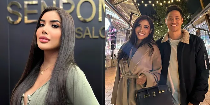 Ngaku Hamil Usai Dilamar, Ini 8 Potret Lawas Millen yang Ganteng Gak Ketolong Saat Masih Remaja