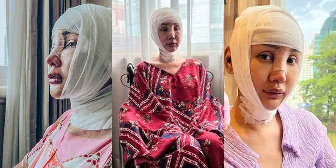 Operasi 'Potong Leher', Potret Lucinta Luna di Masa Penyembuhan: Tetap Ngendorse Meski Kepala Dibalut Perban