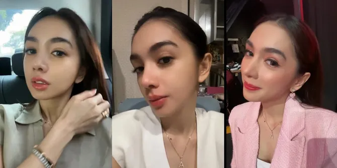 Potret Angel Karamoy Pamer Hasil Operasi Plastik Setelah Tiga Bulan, Sudah Tak Kaku Lagi Kalau Senyum Tapi Masih Susah Ketawa