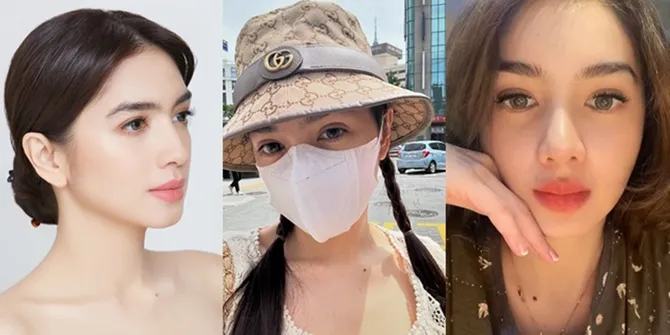 Potret Before After Angel Karamoy Setelah Lakukan Operasi Plastik, Masih Merasa Belum Sempurna