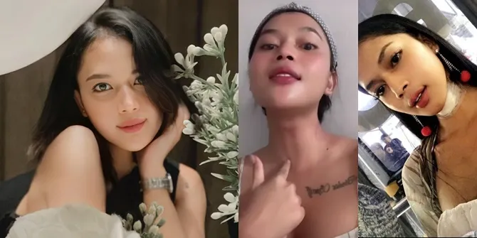 Potret Dinda Syarif Ungkap Proses Penghilangan Jakun, Masih Simpan Sisa Tulang Jakunnya