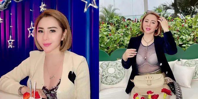 Potret Femmy Permatasari Usai Lakukan Oplas Hidung di Korea, Makin Mancung dan Sukses Bikin Pangling