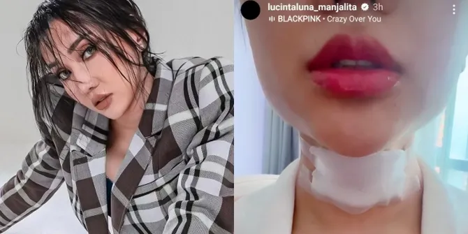 Potret Hasil Operasi 'Tembolok' Lucinta Luna Luka Masih Basah, Hilangkan Suara Khodam - Bikin Ngilu Gak Bisa Nelan