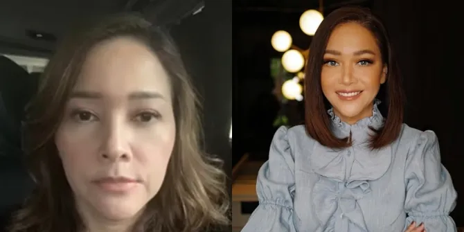 Potret Perubahan Wajah Maia Estianty Setelah Laser dan Botox, Dulu Wajah Mulai Turun - Kini Semakin Cantik dan Muda Banget