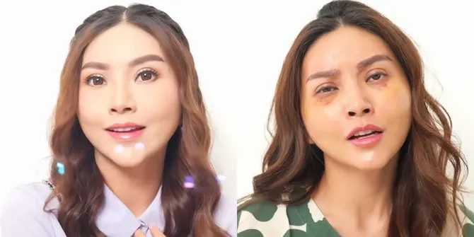 Potret Sarwendah Setelah Operasi Plastik di Korea, Dibilang Lebih Cantik Dulu dan Ciri Khasnya Hilang