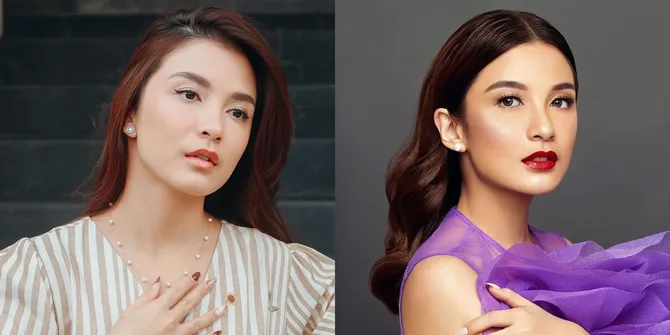 Potret Terbaru Chelsea Olivia Pakai Behel Untuk Rapikan Gigi Gingsul dan Taring, Disayangkan Oleh Fans - Akui Demi Kesehatan