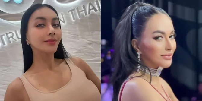 Potret Terbaru Denada Usai Oplas Hidung, Bikin Pangling dan Lebih Percaya Diri