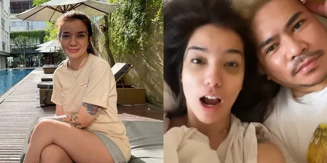 Ramai Dikira KDRT, 7 Potret Sheila Marcia Tunjukkan Kondisi Mata Lebam Sampai Hitam - Bikin Netizen Khawatir