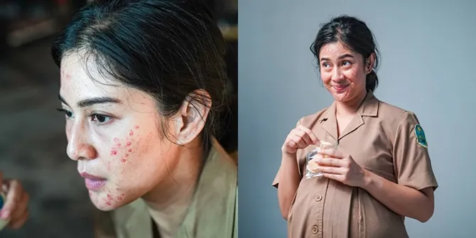Tampil Jerawatan, Intip 8 Potret Terbaru Dian Sastro yang Dijamin Bikin Pangling