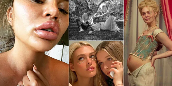 Weekly Hot IG: Foto Baby Bump Meghan Markle - Bibir Chrissy Teigen Bengkak Karena Kulit Jeruk