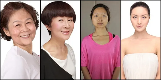 Whoa! Foto-Foto Wanita China Jalani Operasi Plastik Bikin Shock