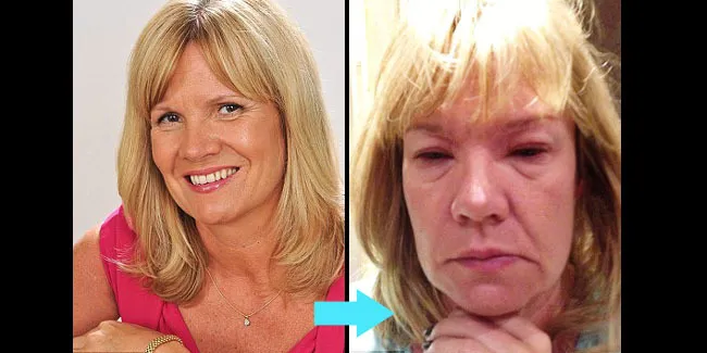 Melanie Beck C Dailymailcouk Vemale