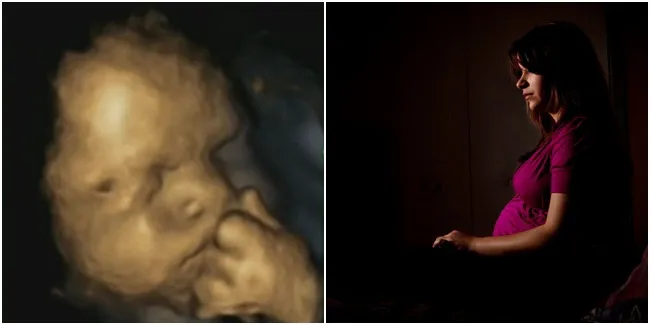Image result for Hal Ini Yang Terjadi Pada Bayi Dalam Kandungan Ketika Ibunya Sedang Menangis atau Stress.