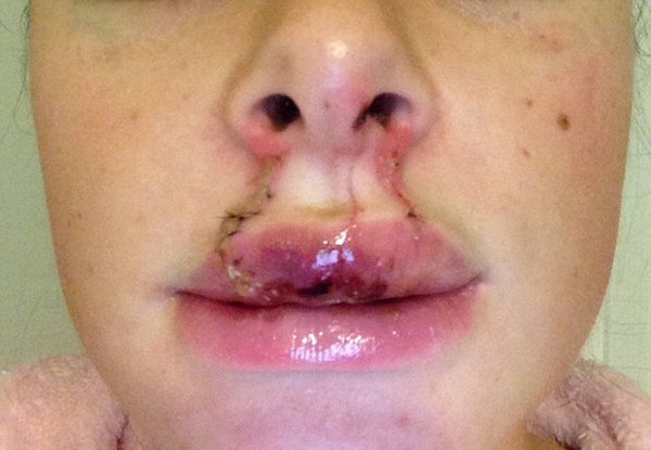Bibir Ward setelah kekerasan oleh Culley | copyright elitedaily.com