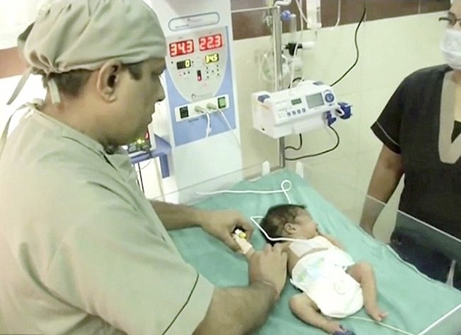 Bayi dalam perawatan dokter setelah di operasi | foto: copyright dailymail.co.uk