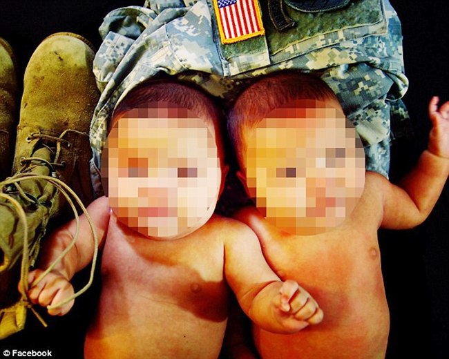 Beruntung, bayi kembar ini, keadaannya sekarang sudah lebih baik | foto: copyright dailymail.co.uk