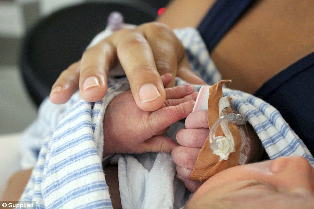 Logan sesaat setelah lahir | Foto: copyright dailymail.co.uk