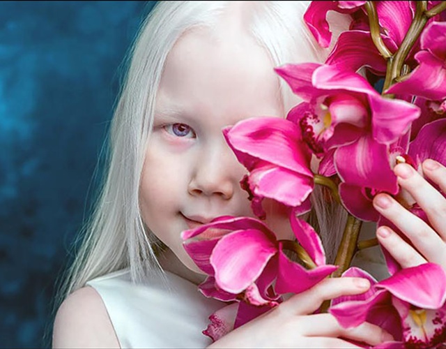 Naryana adalah gadis albino yang sangat unik dan eksotik | Photo: Copyright boredpanda.com