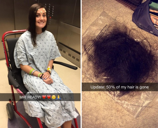 Allie memutuskan memotong semua rambutnya karena kanker otak yang ia derita | Photo: Copyright metro.co.uk