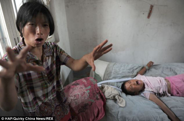 Ma Zimei saat menceritakan kelainan putrinya | Foto: copyright dailymail.co.uk