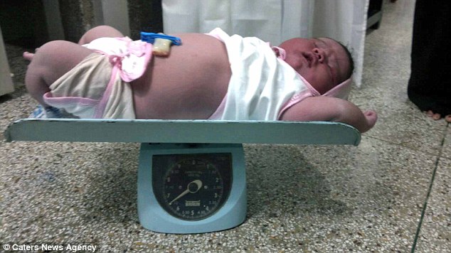 Bayi terbesar di India dengan berat 6,7 kg | Photo: Copyright dailymail.co.uk 