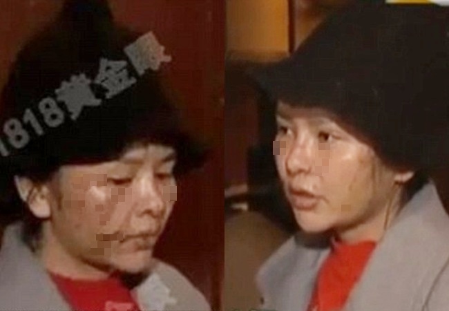 Wajah cantik Tian rusak karena dirusak oleh temannya sendiri | Photo: Copyright asiantown.net
