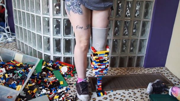 Christina Menunjukkan Bagian Kaki Legonya (c) abcnews.go.com