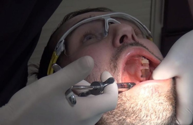 Michael melakukan implan gigi agar kesehatannya lebih membaik/copyright odditycentral.com