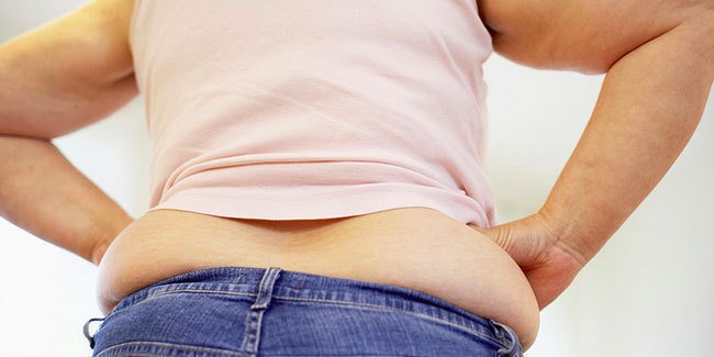 Kelebihan berat badan karena kondisi langka/copyright Shutterstock.com