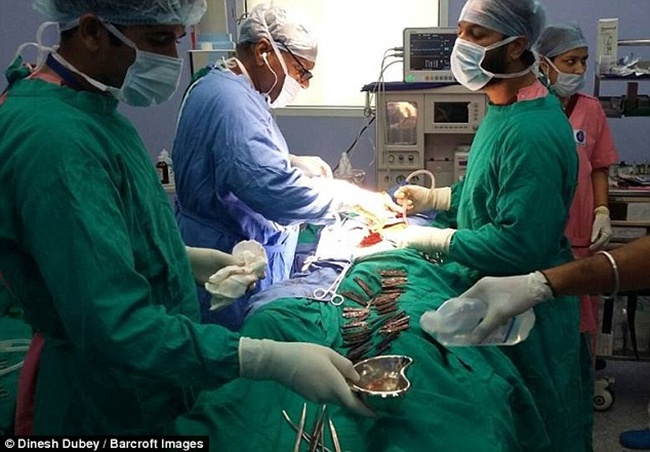 Dokter melakukan operasi untuk mengangkat 40 pisau dari dalam perut pasien | Photo: Copyright asiantown.net