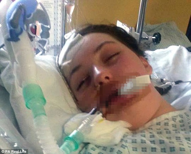 Rachel mengalami koma dan tak sadarkan diri selama 23 hari | Photo: Copyright dailymail.co.uk