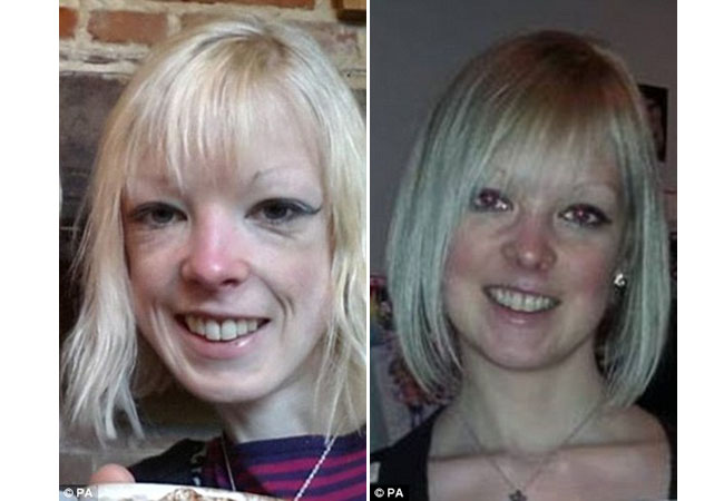 Sebelum dan sesudah, sekarang jauh lebih sehat dan cantik | Foto: copyright dailymail.co.uk